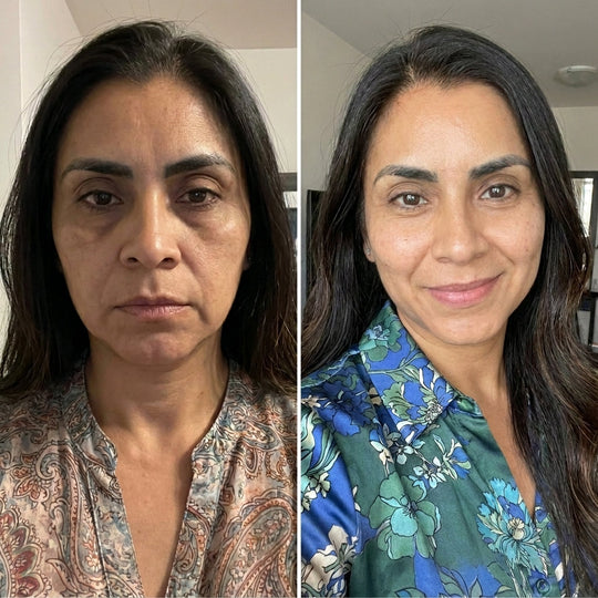 PDRN Collagen Volume Multi Balm